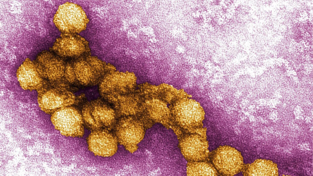 Electron microscope image of West Nile virus particles, colored gold against a purple background.